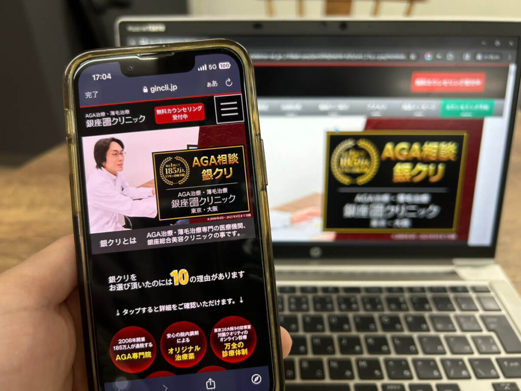 銀座総合美容外科クリニックの公式サイト画面の画像