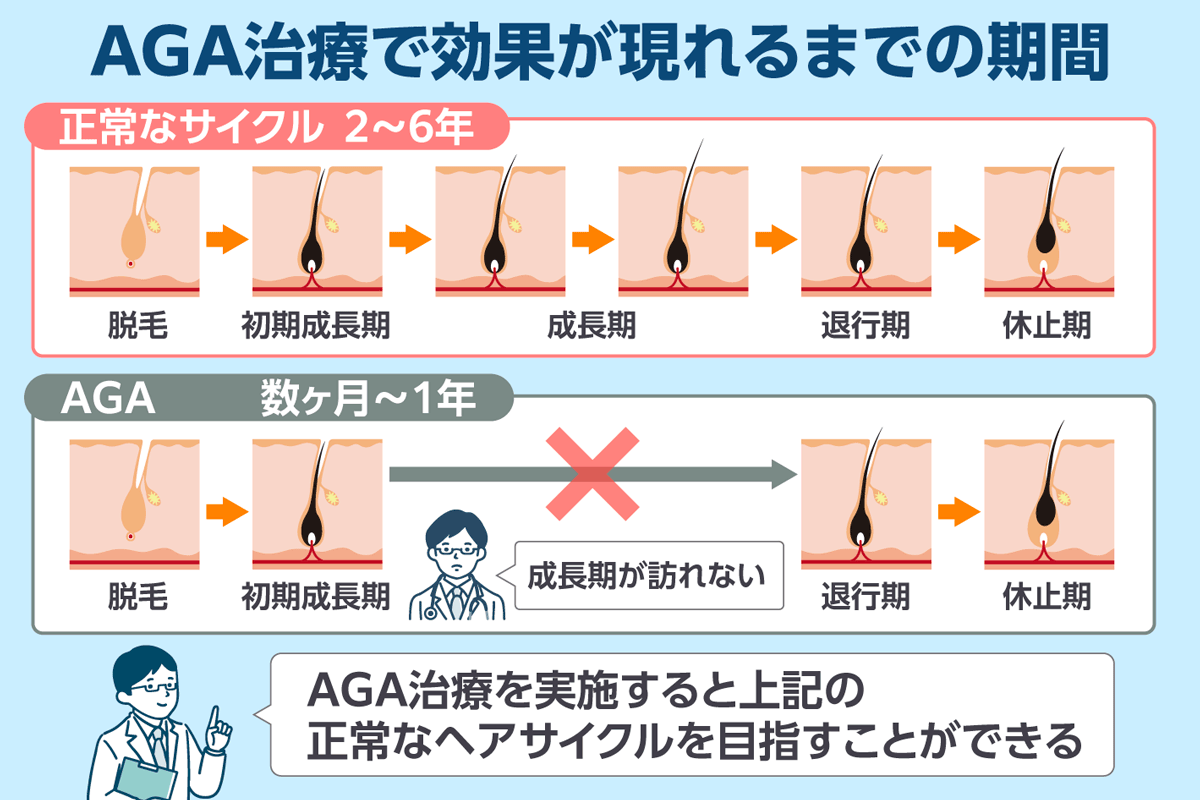 AGA治療で効果が現れるまでの期間