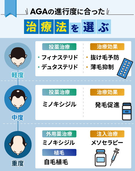 AGAの進行度に合った治療法