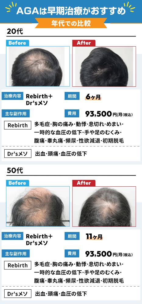 AGAの年代別の症例比較図